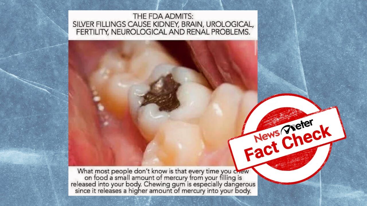 Do silver dental fillings cause serious health issues?