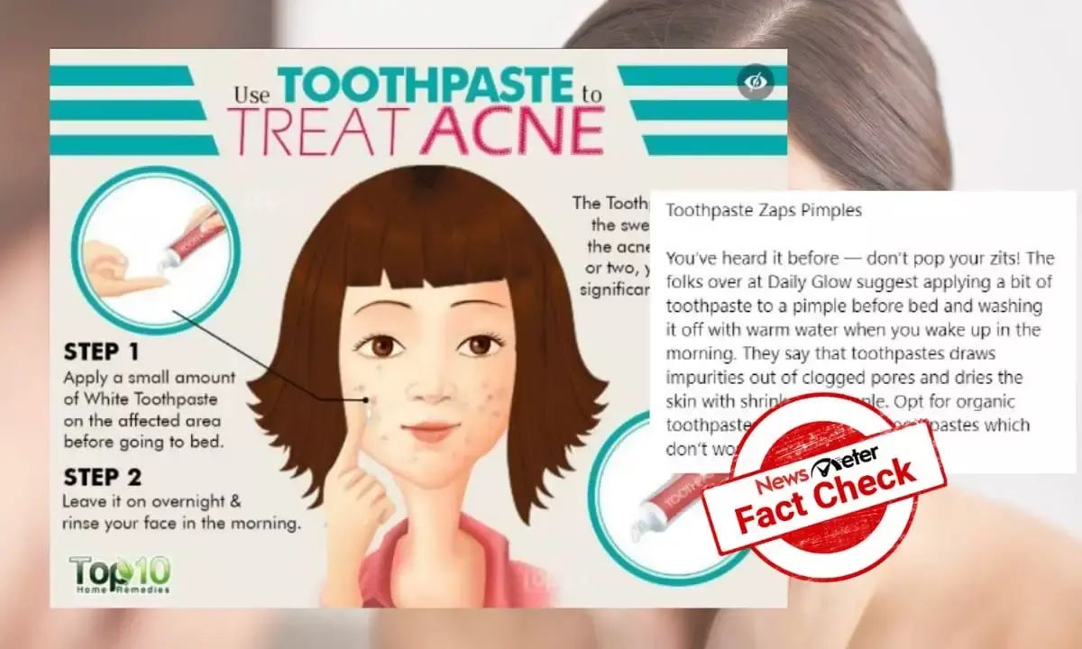 Can applying toothpaste cure acne?