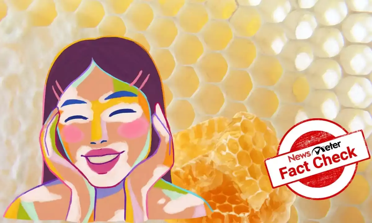 Can Vitiligo be treated by applying burnt honeycomb?