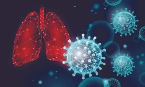 Is there a link between Covid-19 and lung cancer? Experts explain