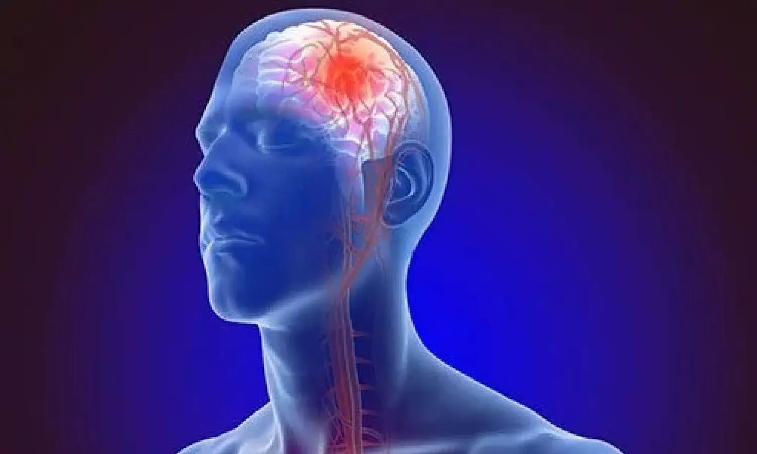 Can cold water baths cause strokes during winter? Heres what doctors say