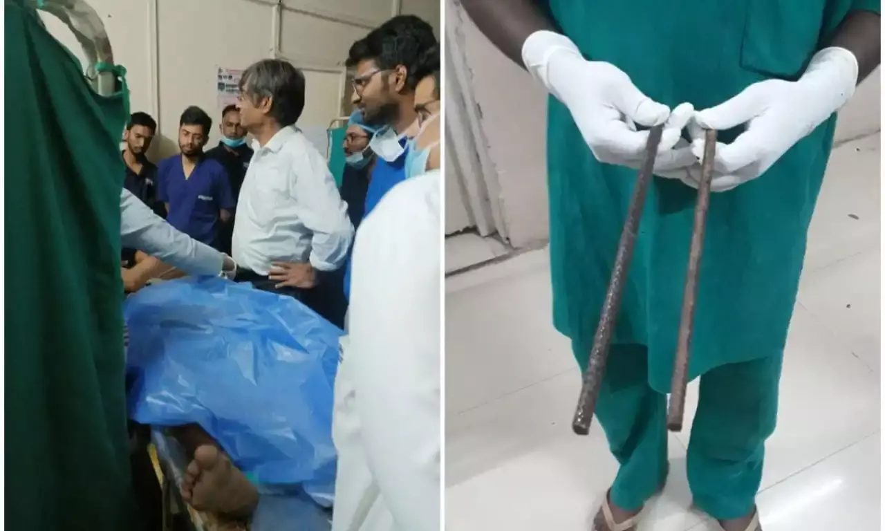 Osmania docs, NGO swoop in to save migrant worker impaled by rods in Abids accident