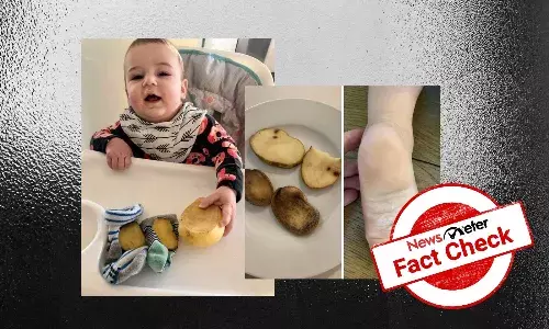 Can a slice of potato in socks combat cold and flu?