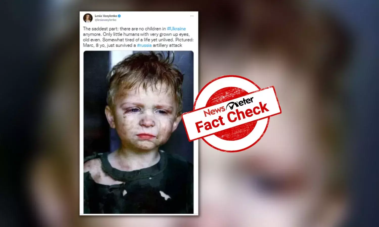 This image does not show a child survivor of Russia-Ukraine war