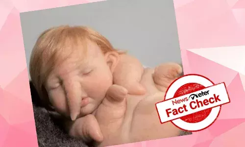 Is this half-human/half-elephant baby a reincarnation of Lord Ganesha?