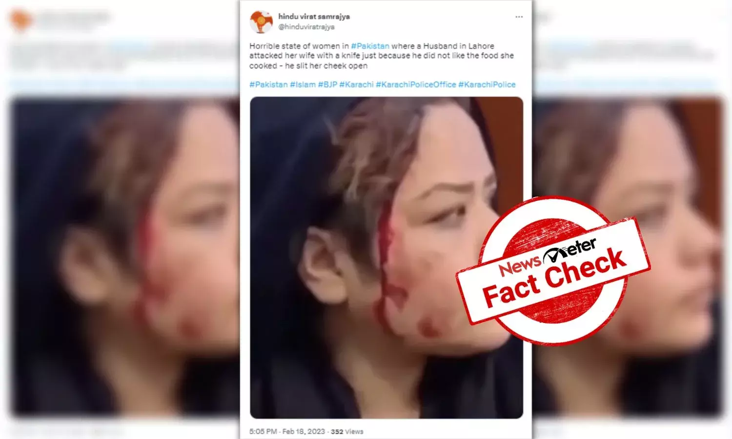 Photo of injured Afghan activist passed off as domestic violence victim from Pak