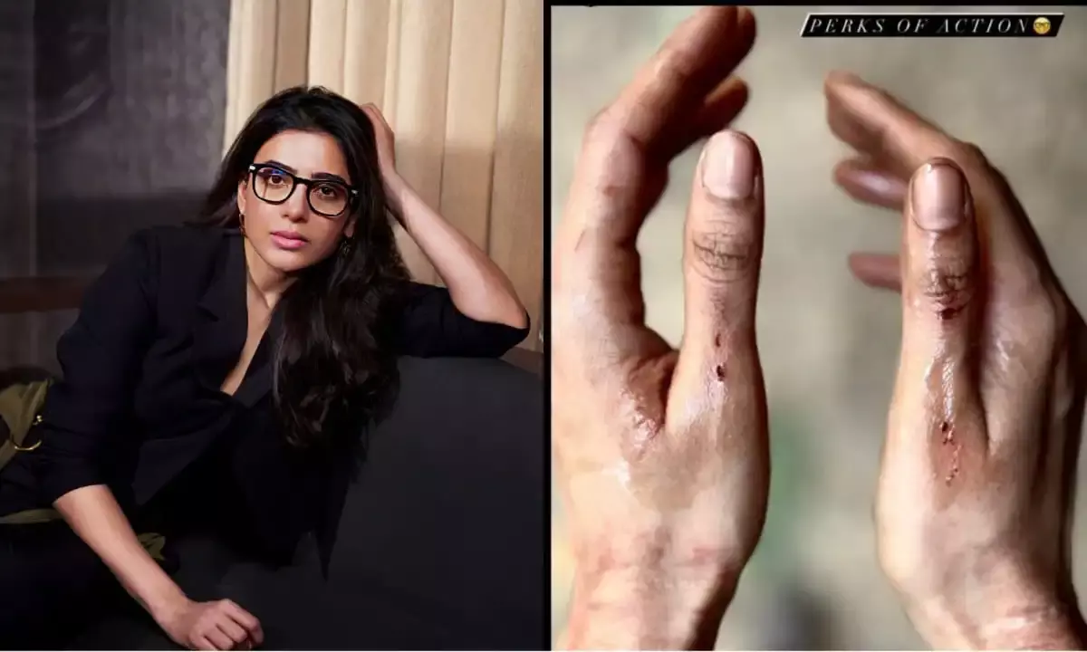 Perks of Action: Of Samantha, myositis, and stunts