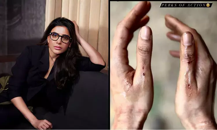 Perks of Action: Of Samantha, myositis, and stunts