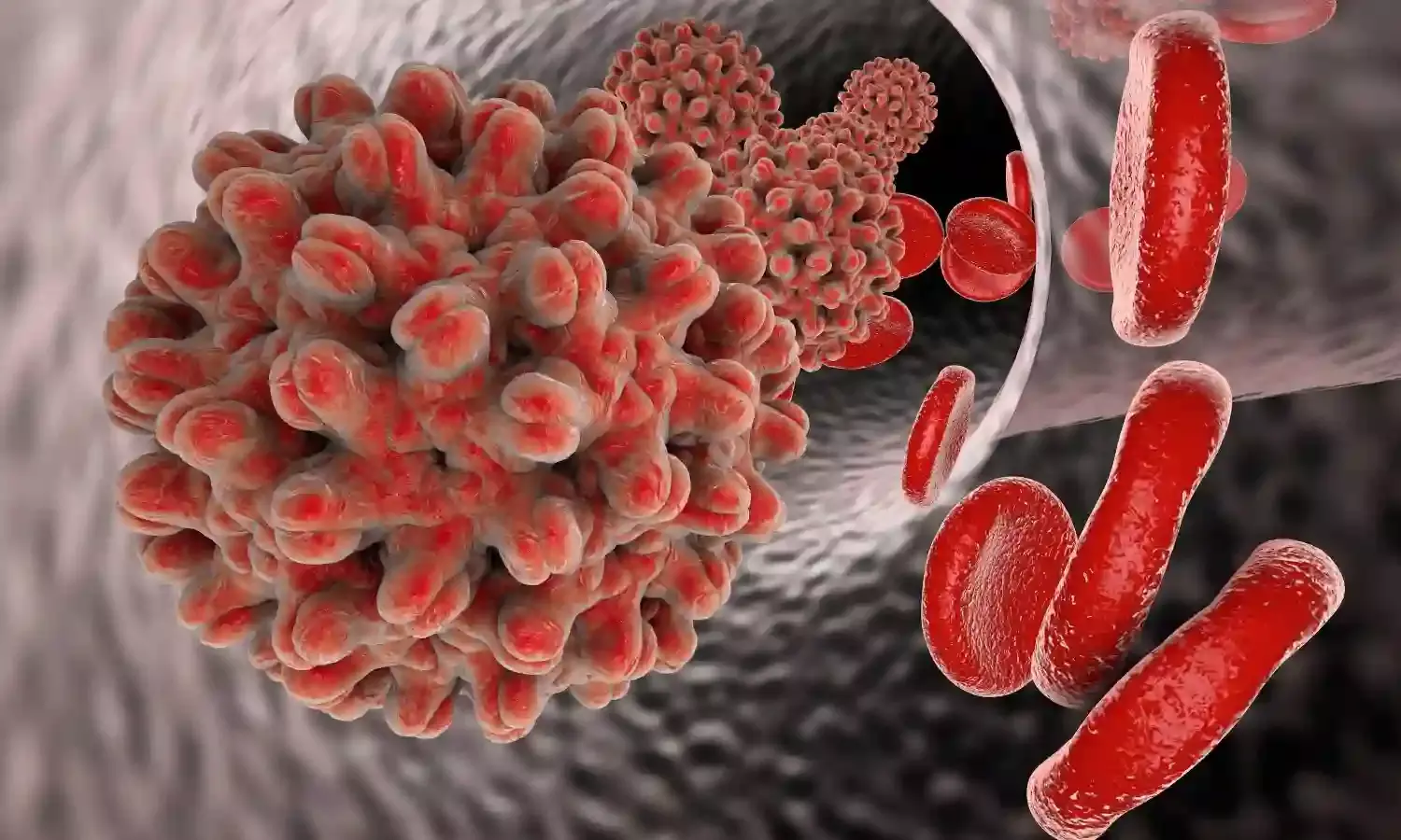 What is Hepatitis B? Why has CDC recommended universal screening?