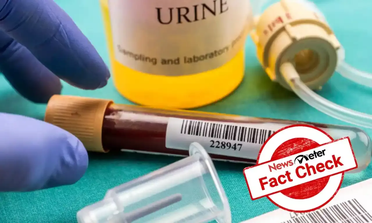 Does drinking urine improve eyesight? Viral post debunked
