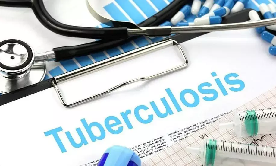 Tuberculosis