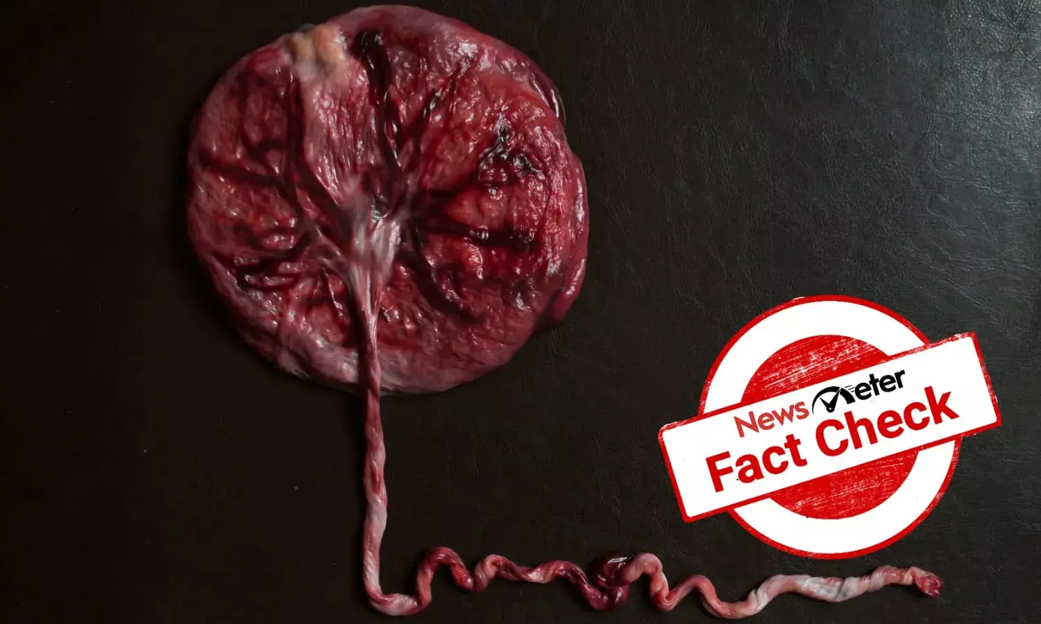 Should new mothers eat the placenta after giving birth?