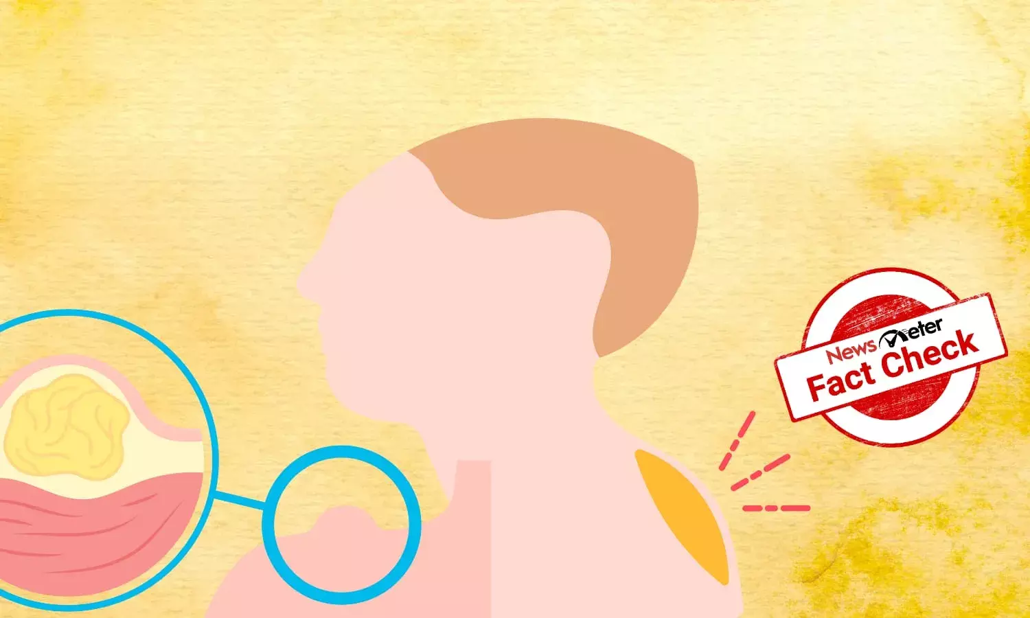 Can this ointment cure lipoma?