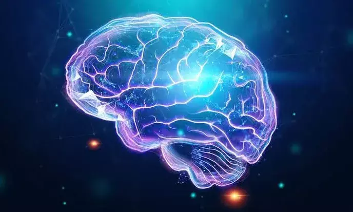 Representational Image