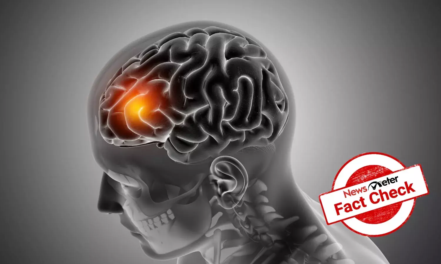 Does Interphone Study link smartphone usage to brain tumors?