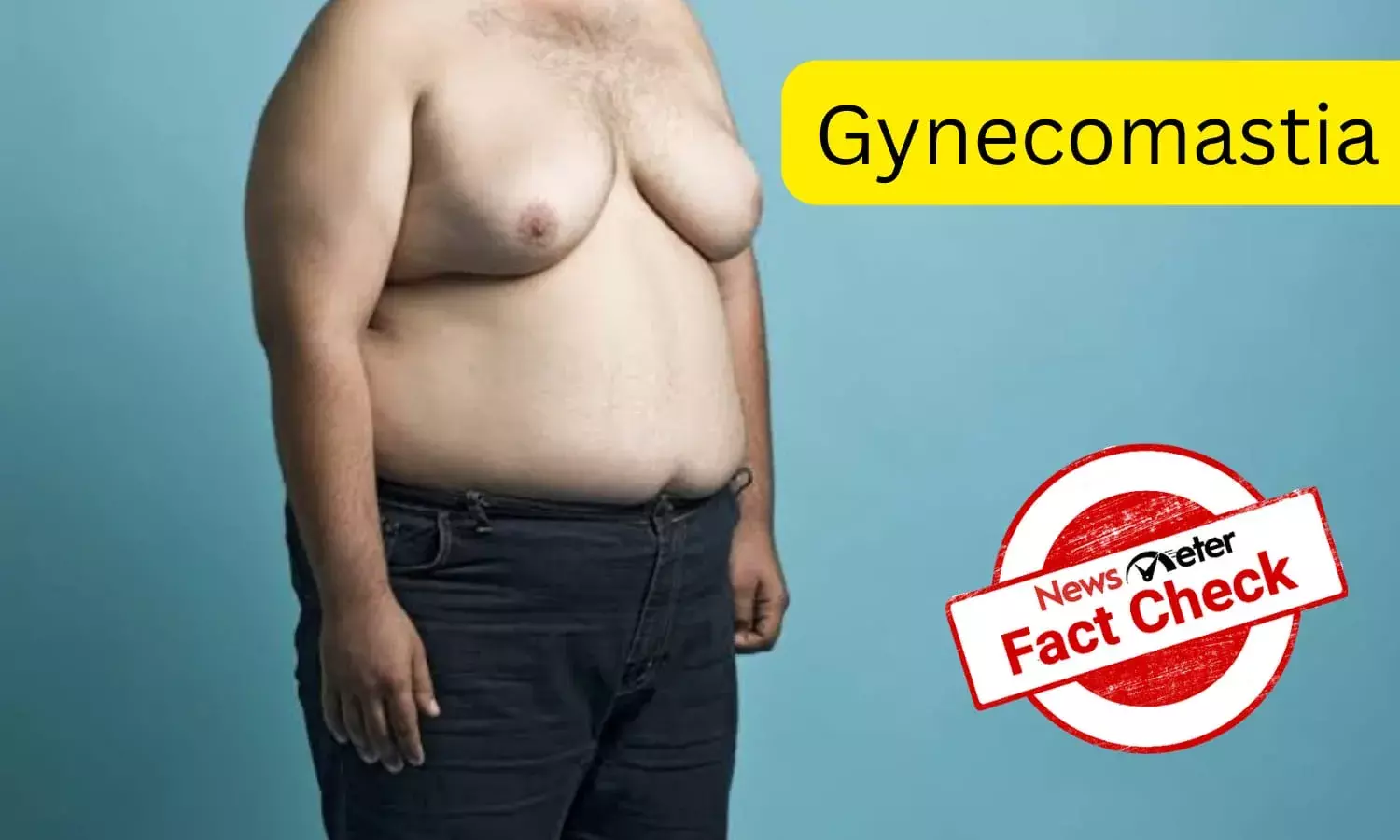 Fact Check: No topical creams or supplements can help reduce gynecomastia