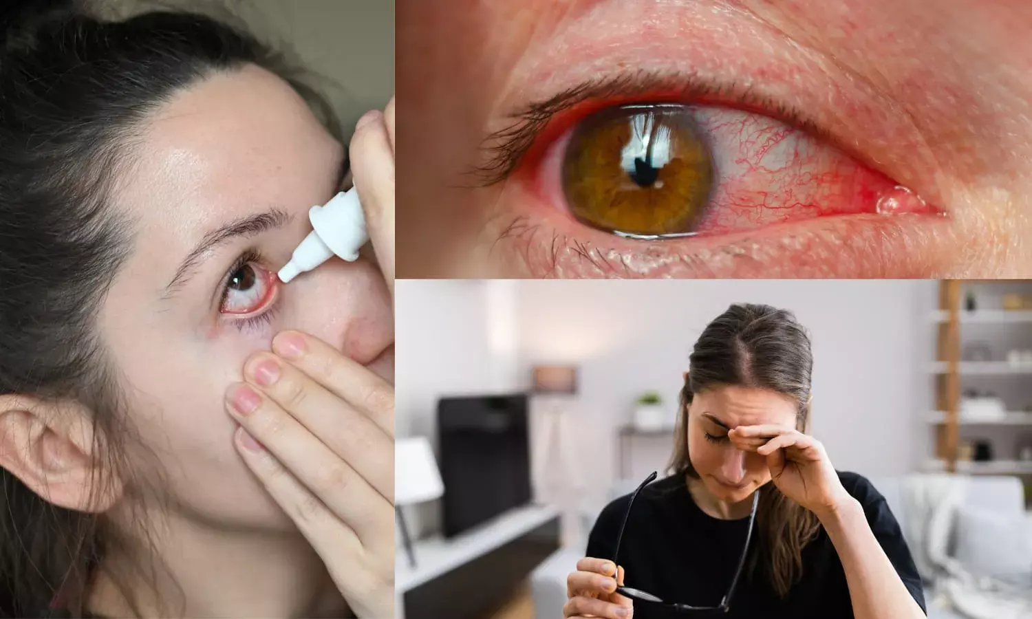 Doctors Talk: All about Conjunctivitis with Dr.Kuldeep Raizada