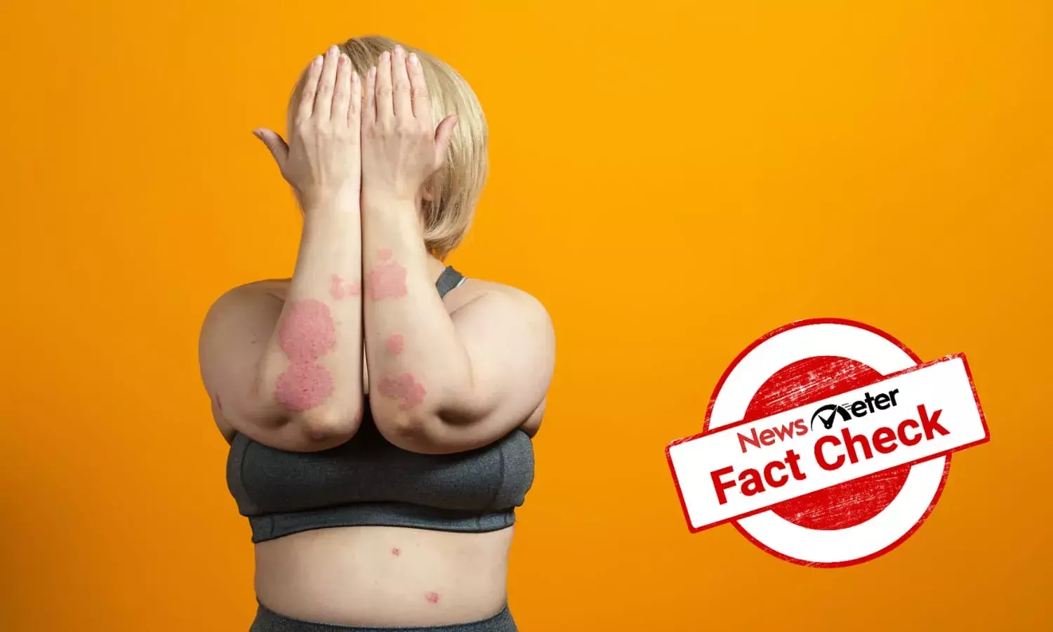 Fact Check: Can Atoderma cream treat psoriasis and eczema in 7 days? No