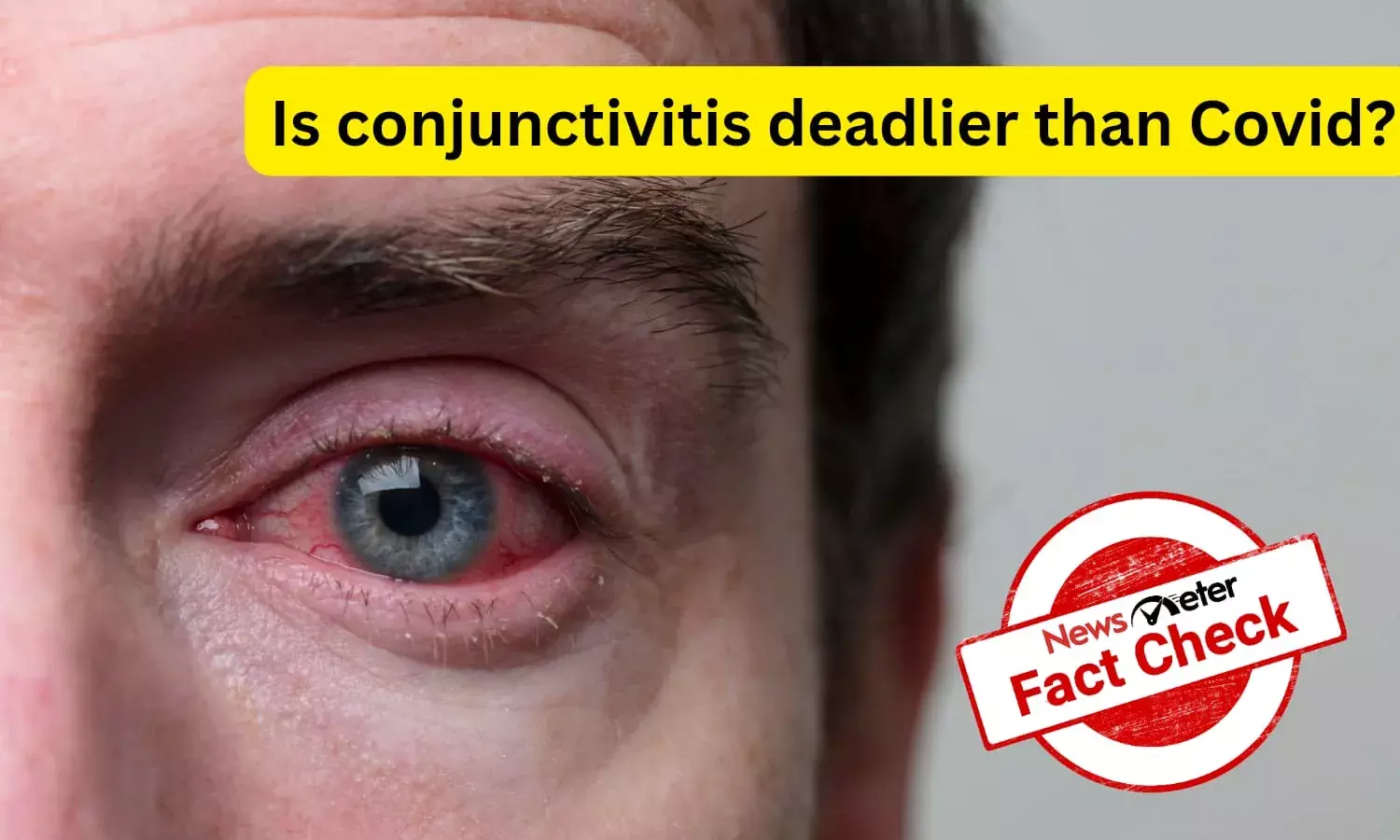 Fact Check: Is viral conjunctivitis as deadly as Covid-19?