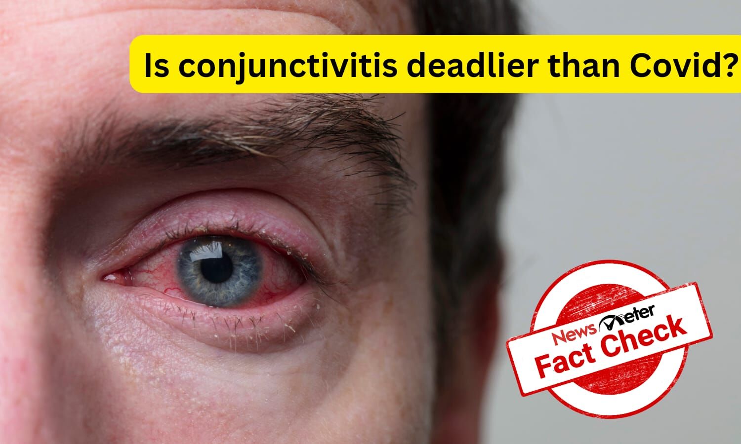 conjunctivitis-alert-can-you-get-eye-flu-by-looking-into-someone-s