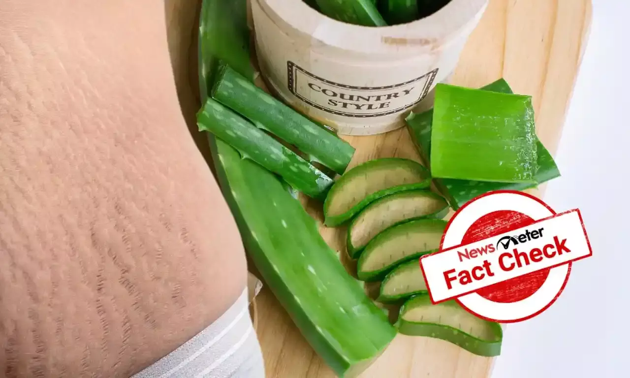 Fact Check: Can aloe vera gel and baking soda erase stretch marks completely?