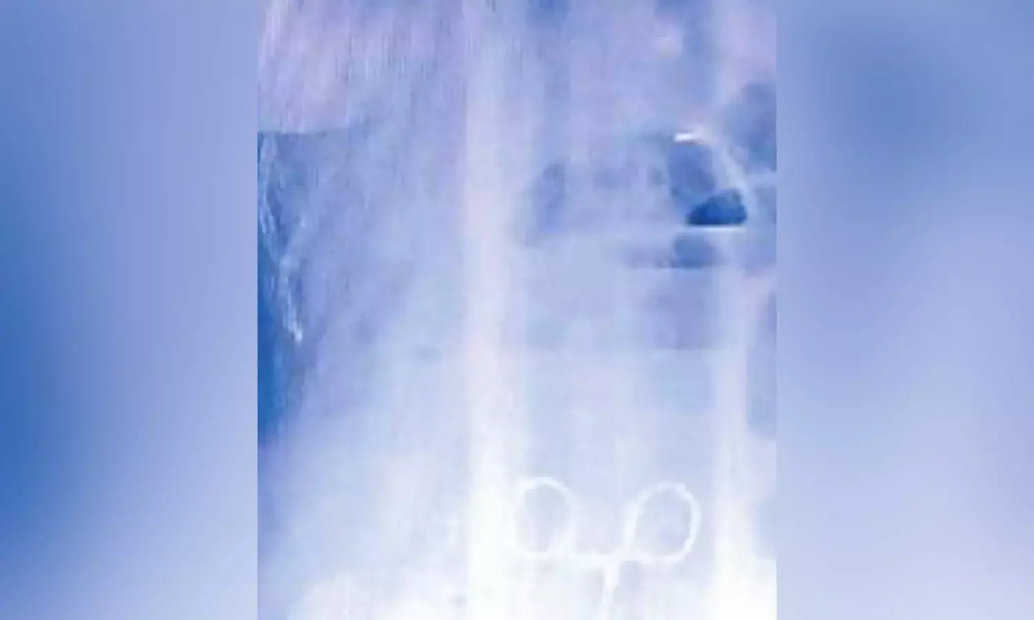 Doctors in Eluru govt hosp leave forceps in womans stomach, removed after 4 months