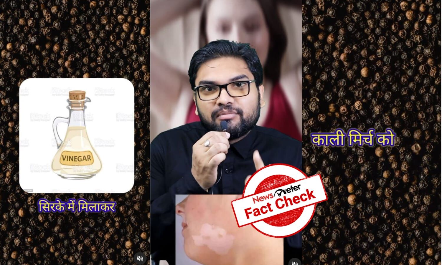Fact Check Can vinegar and black pepper treat vitiligo?