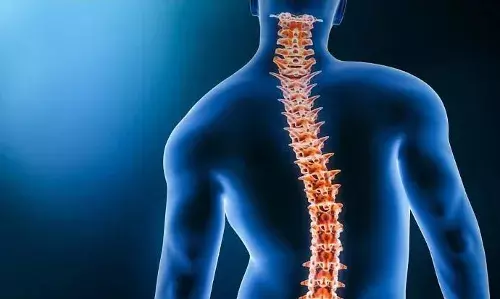 Hyderabad: How Dr. Suresh Cheekatla helped girl to overcome hunchback, spinal deformity