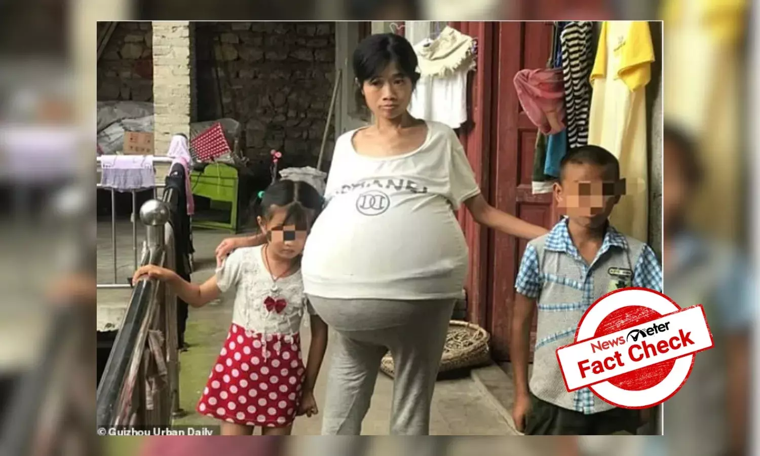 Fact Check: Video of a woman suffering from ovarian cancer shared with false claim