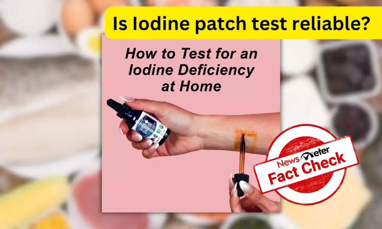 Fact Check: Does the ‘iodine patch test’ provide accurate results?
