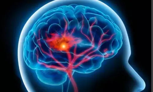 1out of 3 stroke patients suffer long-term health complications