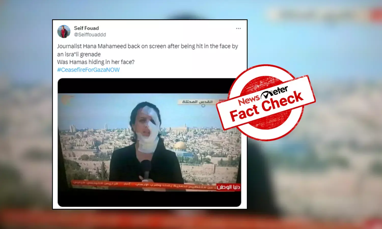 Fact Check: Old image of journalist with bandaged face linked to ongoing Israel-Hamas conflict