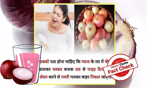 Fact Check: No, drinking an onion-sugar concoction wonāt dissolve kidney stones in 15 days