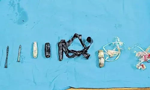 Blade, nails, tape:  Doctors remove sharp objects from Chanchalguda prisoners stomach