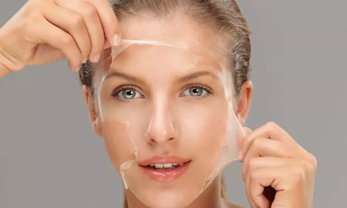 Skin Health Alert: Consult dermatologist before using skin peels to avoid damage