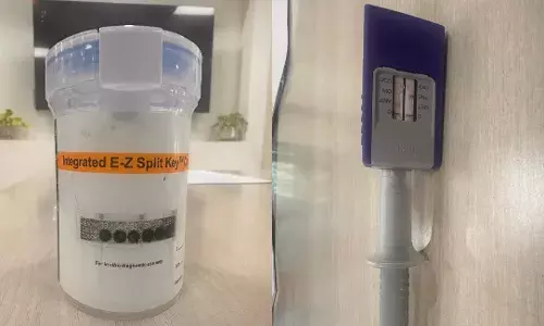 In a first, Telangana Anti Narcotics Bureau introduces instant drug detection tests which give results in 5 minutes