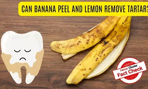 Fact Check: Can banana peel, lemon and salt mix help remove tartar, whiten teeth?