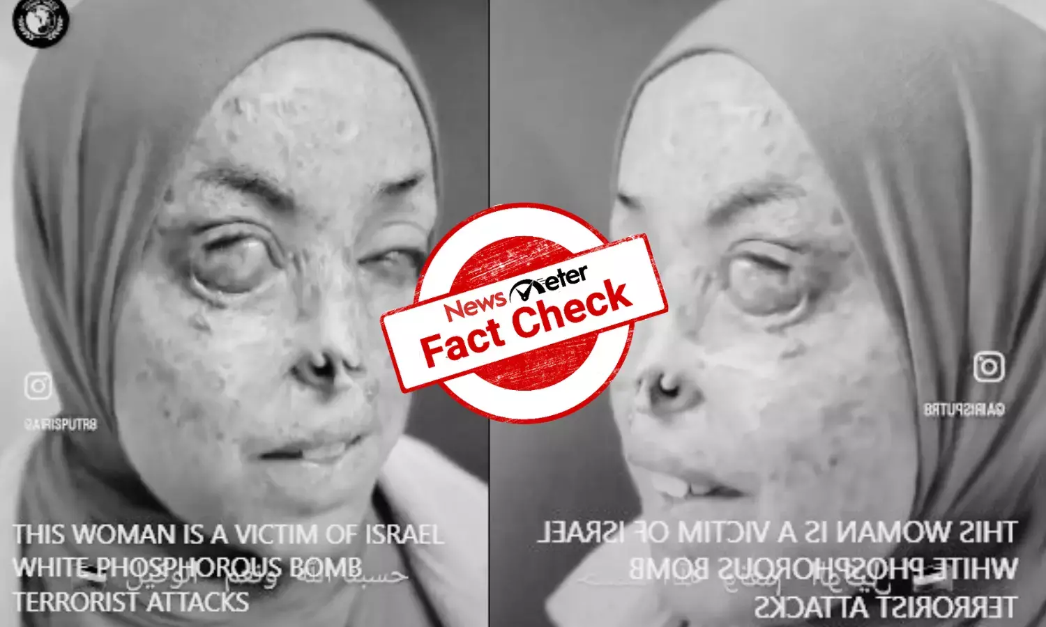 Fact Check: Video of woman with skin ailment shared as victim of Israel’s phosphorous bomb