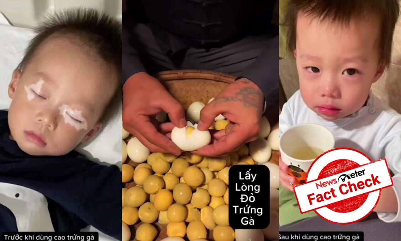 Fact Check Can oil extracted from egg yolks treat vitiligo?