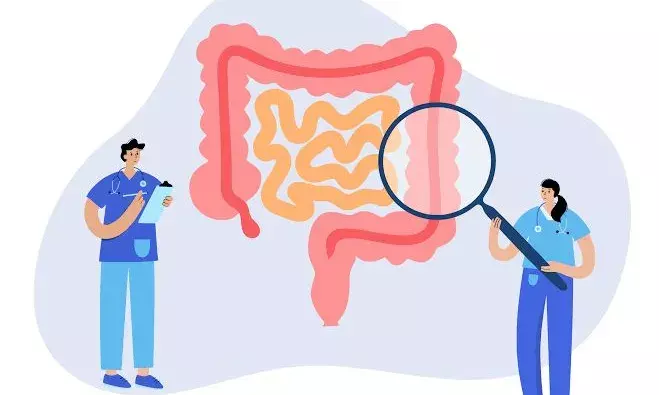 An unspoken pandemic: Hyderabad reports increase in colorectal cancer among young population