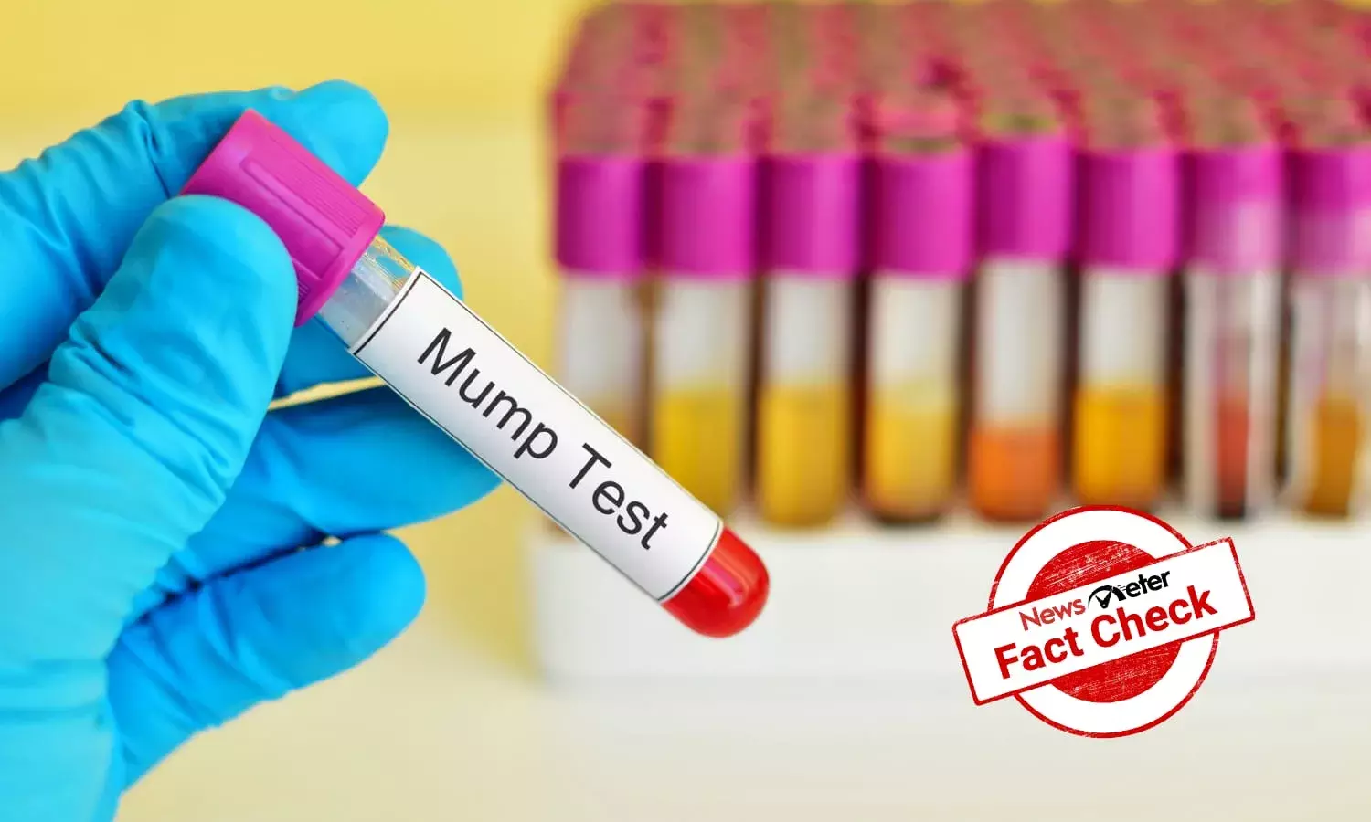 Fact Check: No need to panic! Mumps infection is all under control; here are dos and don’ts