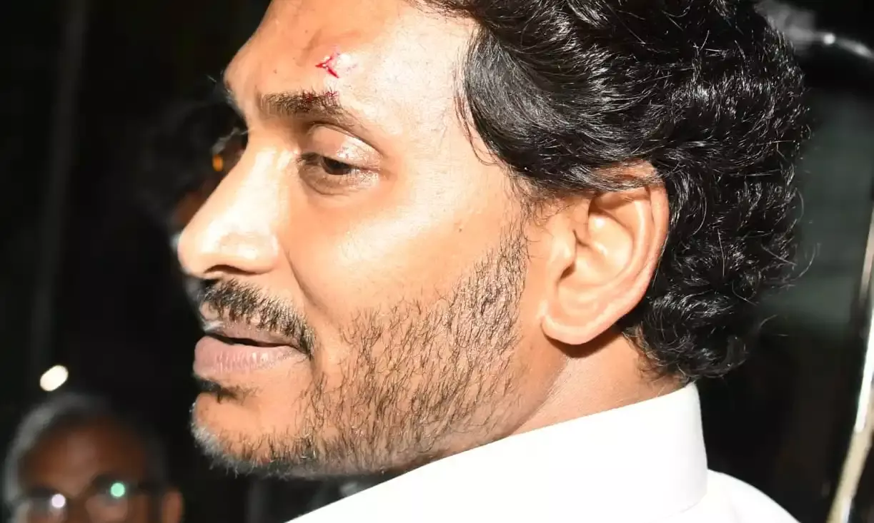 Stone pelting: Jagan suffers injury on forehead at Memantha Siddham yatra