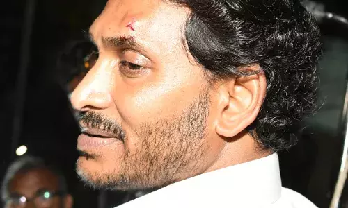 Stone pelting: Jagan suffers injury on forehead at Memantha Siddham yatra