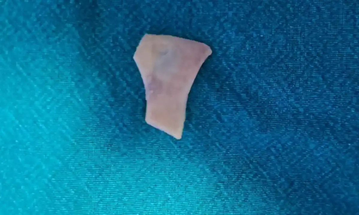 Hyderabad: Kamineni docs remove mutton bone stuck near heart in elderly patient