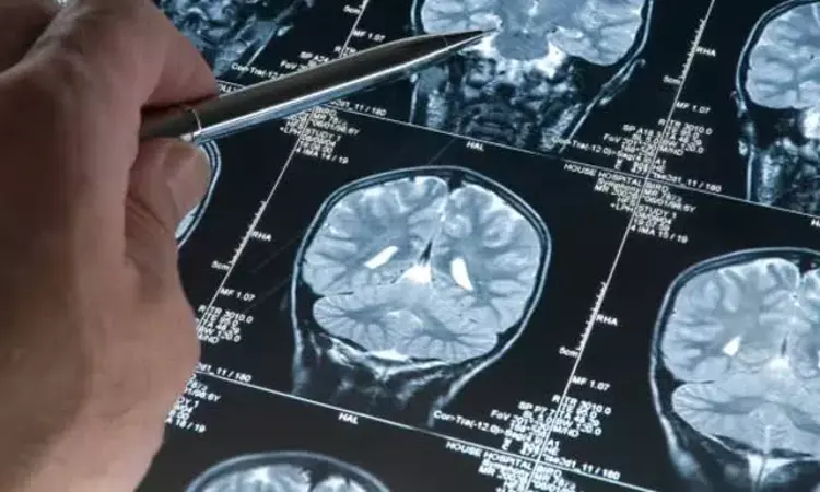 5-year-old girl in Kerala dies of infection caused by brain-eating amoeba