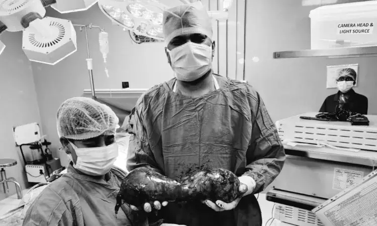 AINU docs remove rare dumbbell-shaped giant testis tumour from Kadapa man