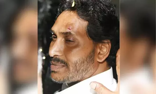 Court grants bail to youth who allegedly pelted stone at Andhra CM
