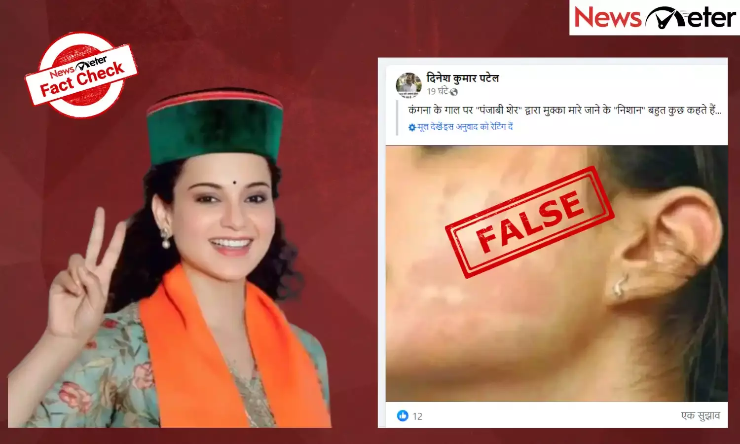 Fact Check: Do viral photos show injuries on Kangana Ranaut after assault by CISF officer?
