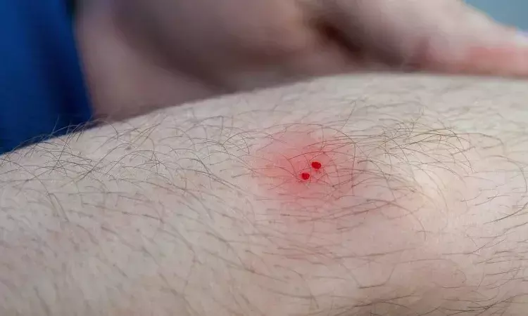 Unseen Danger: Anantapur boy almost dies from undetected snake bite