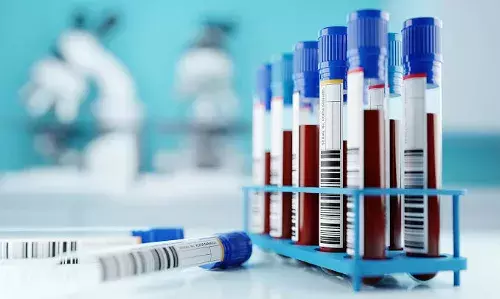 Health Ministry issues guidelines for ethical use of leftover, de-identified and anonymous samples for commercial use